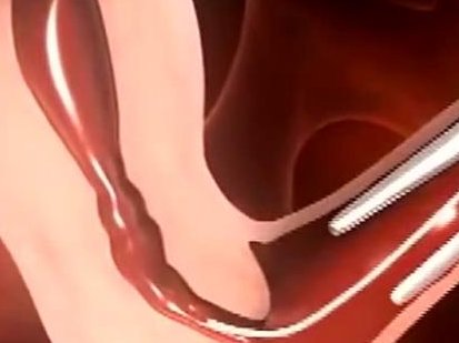 滨州附属医院试管婴儿助孕省钱攻略